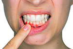 Non-Surgical Gum Treatments